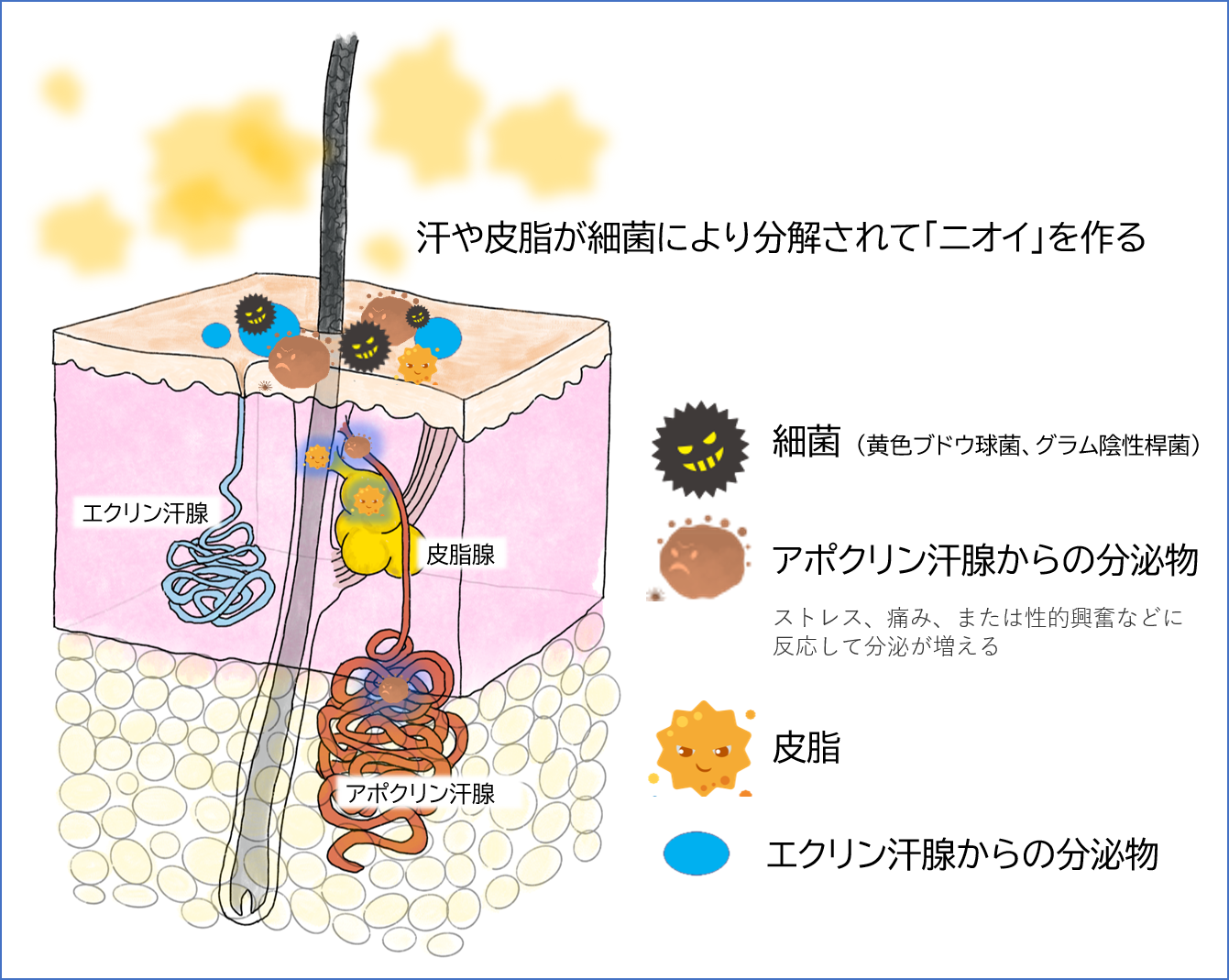 ワキガ（腋臭症）の治療〜ニオイの診断と手術～｜日本医科大学武蔵小杉病院