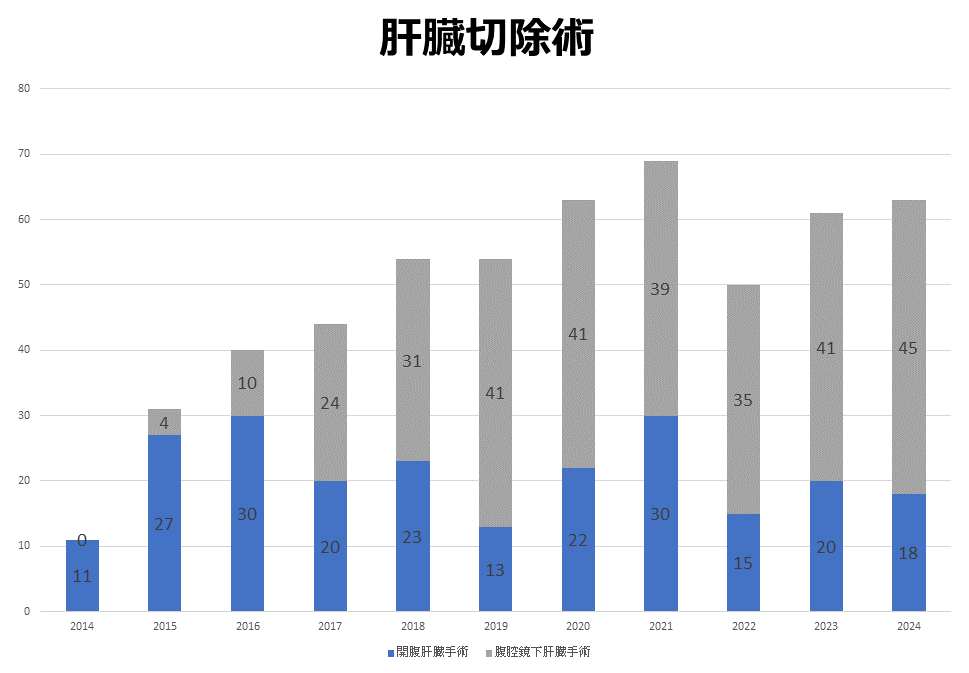 肝臓切除術